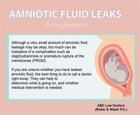 leaking fluid pregnancy|Leaking Amniotic Fluid 